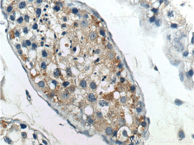 RXFP1 Antibody in Immunohistochemistry (Paraffin) (IHC (P))