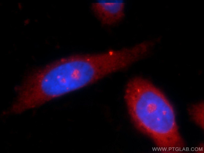 P62/SQSTM1 Antibody in Immunocytochemistry (ICC/IF)