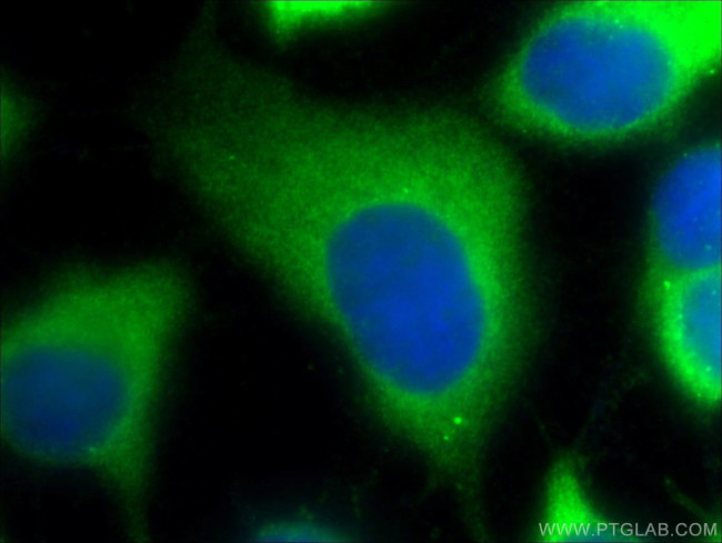 P62/SQSTM1 Antibody in Immunocytochemistry (ICC/IF)