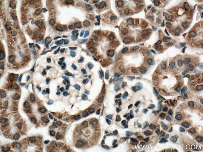 P62/SQSTM1 Antibody in Immunohistochemistry (Paraffin) (IHC (P))