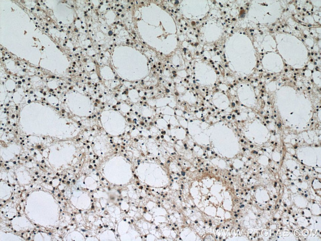 P62/SQSTM1 Antibody in Immunohistochemistry (Paraffin) (IHC (P))