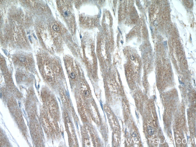 P62/SQSTM1 Antibody in Immunohistochemistry (Paraffin) (IHC (P))