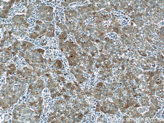 P62/SQSTM1 Antibody in Immunohistochemistry (Paraffin) (IHC (P))