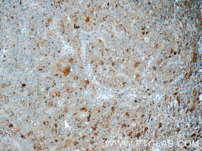 P62/SQSTM1 Antibody in Immunohistochemistry (Paraffin) (IHC (P))