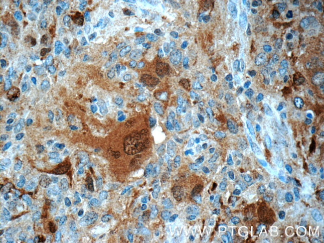 P62/SQSTM1 Antibody in Immunohistochemistry (Paraffin) (IHC (P))