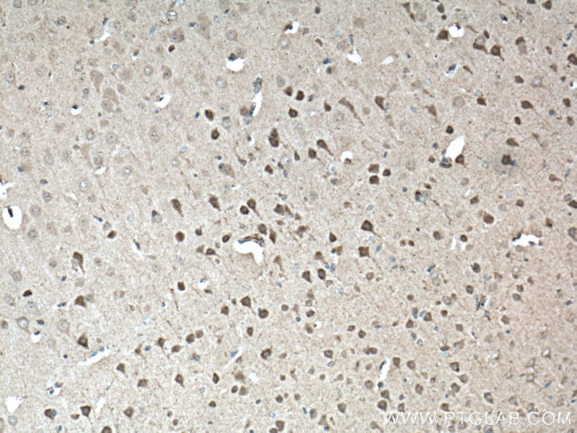 P62/SQSTM1 Antibody in Immunohistochemistry (Paraffin) (IHC (P))