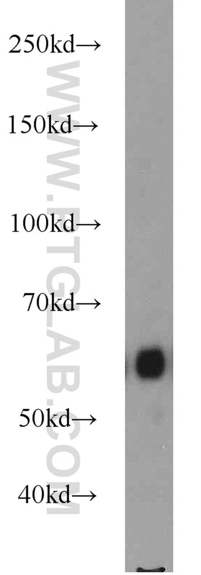 P62/SQSTM1 Antibody in Western Blot (WB)