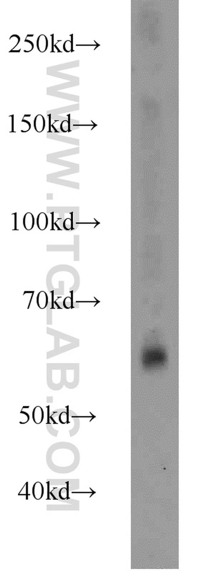 P62/SQSTM1 Antibody in Western Blot (WB)