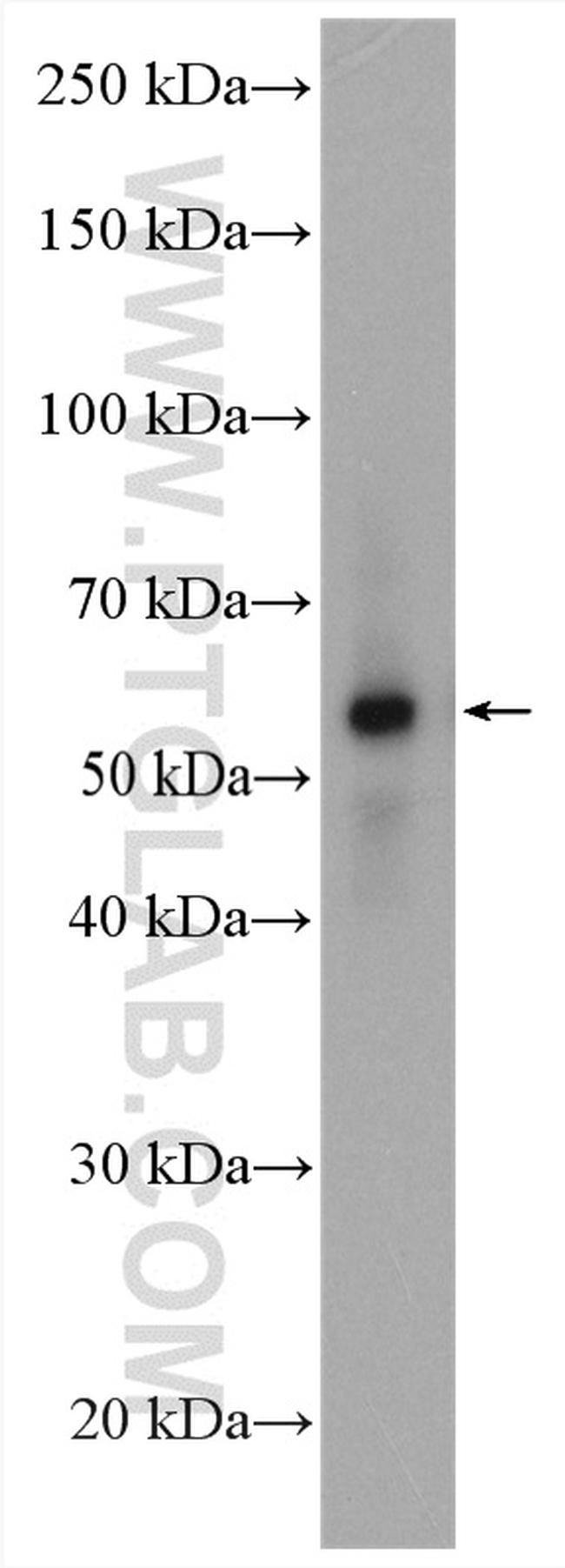 P62/SQSTM1 Antibody in Western Blot (WB)