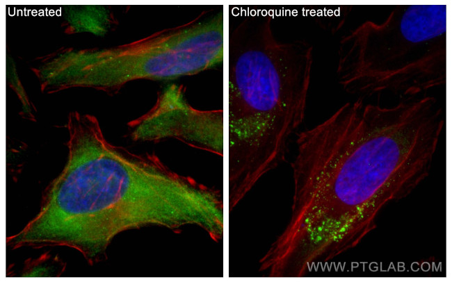 P62/SQSTM1 Antibody in Immunocytochemistry (ICC/IF)