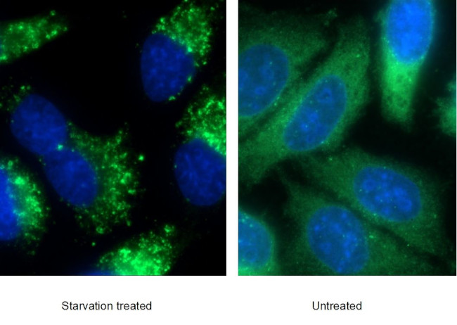 P62/SQSTM1 Antibody in Immunocytochemistry (ICC/IF)