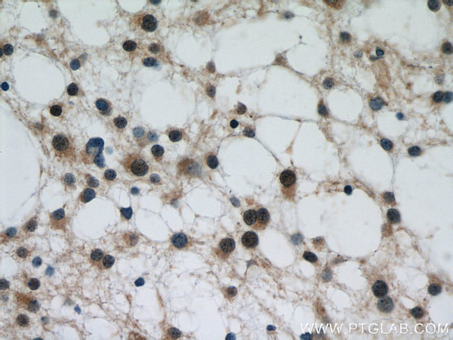 P62/SQSTM1 Antibody in Immunohistochemistry (Paraffin) (IHC (P))