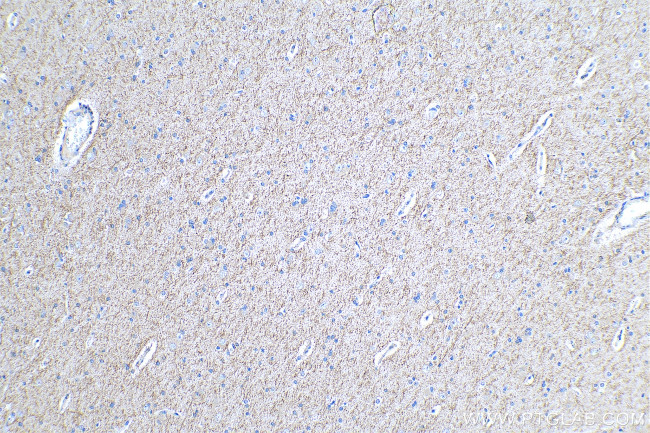 P62/SQSTM1 Antibody in Immunohistochemistry (Paraffin) (IHC (P))