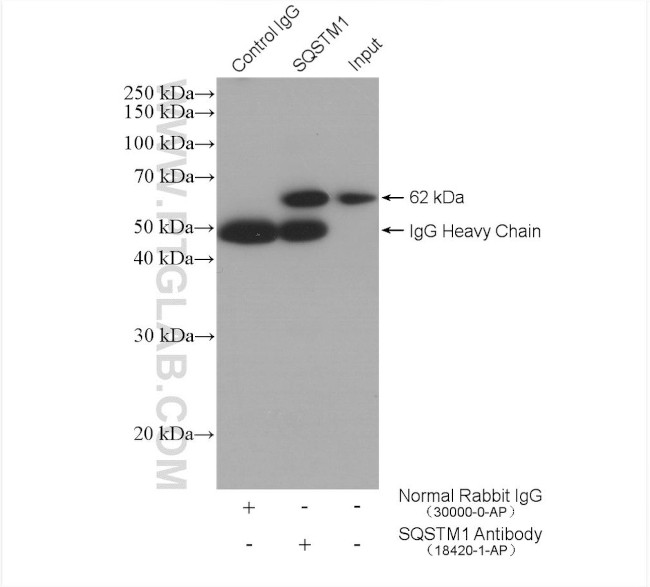 P62/SQSTM1 Antibody in Immunoprecipitation (IP)