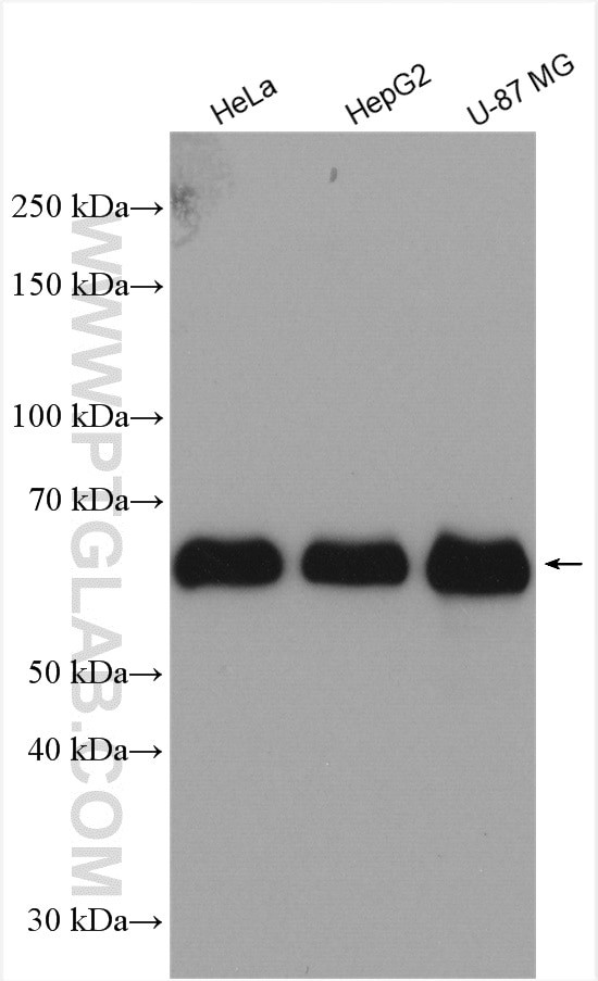 P62/SQSTM1 Antibody in Western Blot (WB)