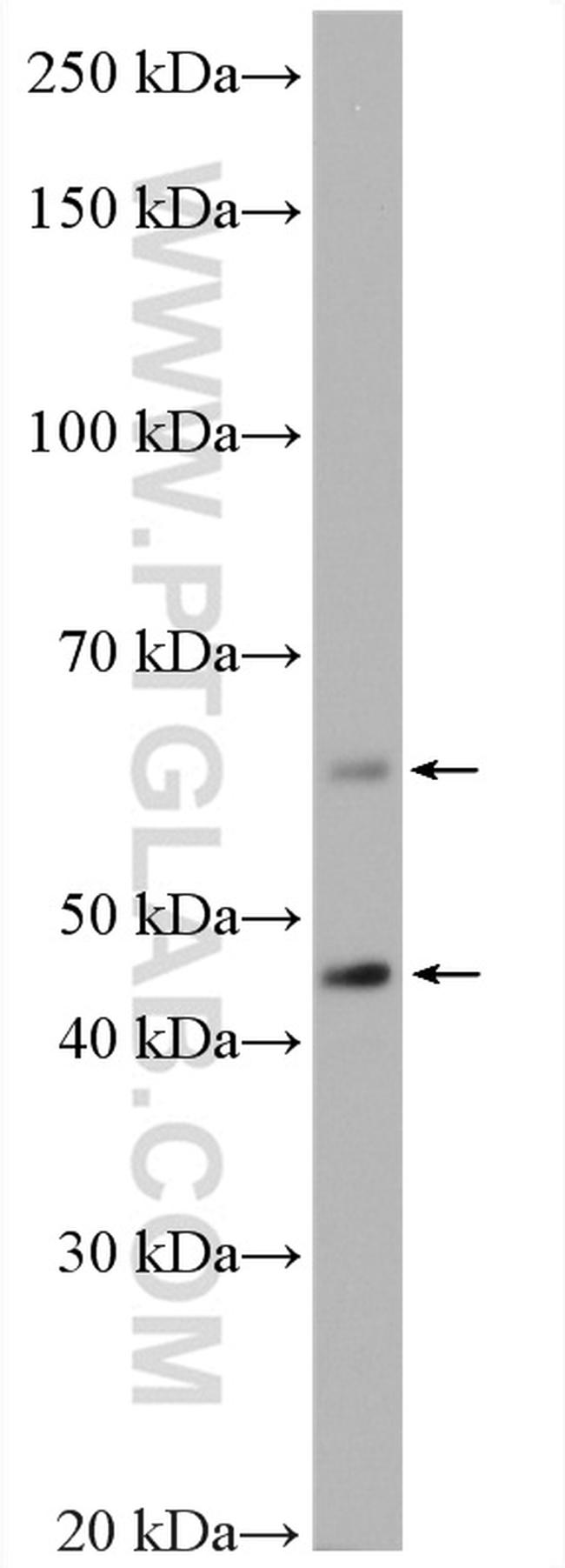 P62/SQSTM1 Antibody in Western Blot (WB)