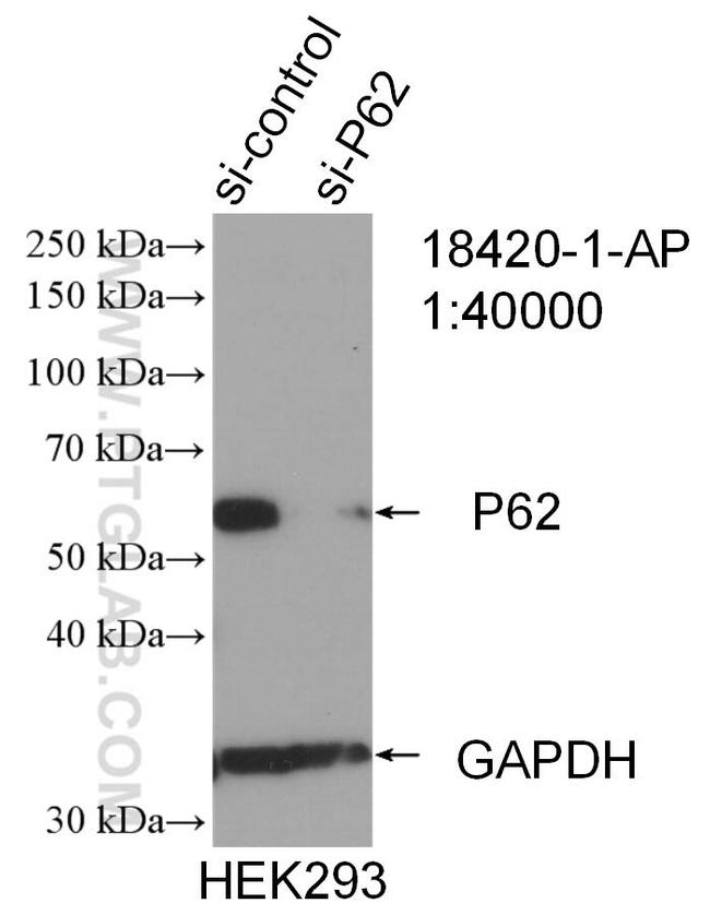 P62/SQSTM1 Antibody in Western Blot (WB)