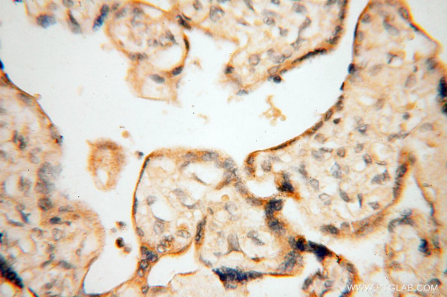 Calsequestrin 2 Antibody in Immunohistochemistry (Paraffin) (IHC (P))