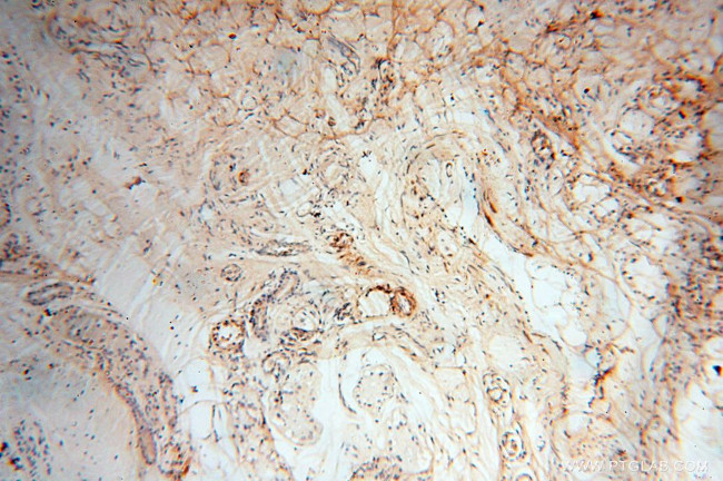 Calsequestrin 2 Antibody in Immunohistochemistry (Paraffin) (IHC (P))