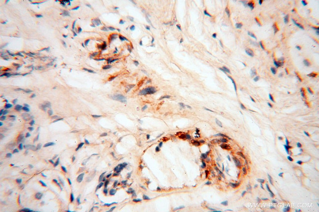 Calsequestrin 2 Antibody in Immunohistochemistry (Paraffin) (IHC (P))