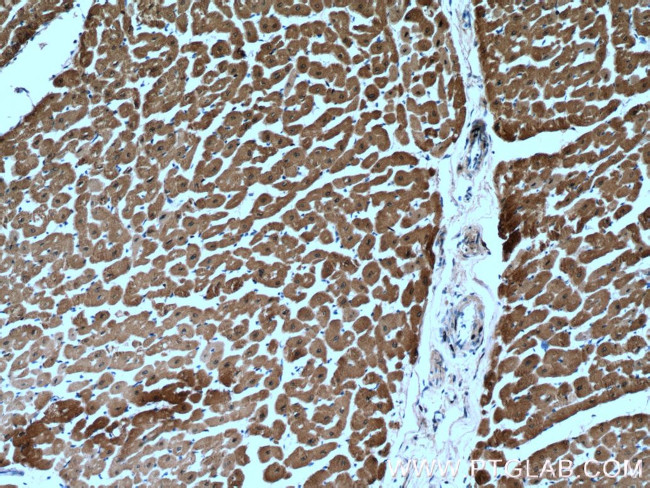 Calsequestrin 2 Antibody in Immunohistochemistry (Paraffin) (IHC (P))