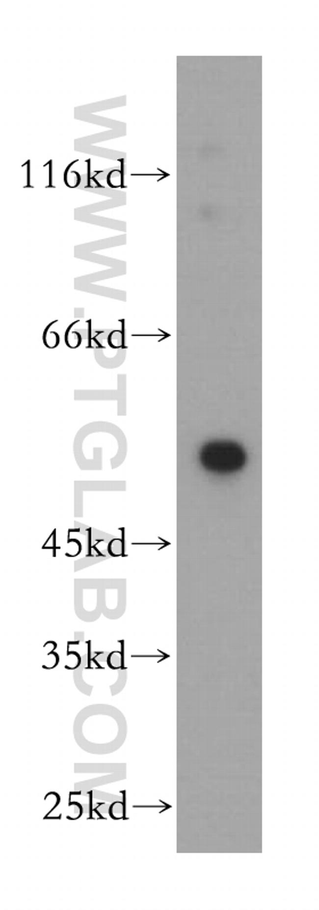 Calsequestrin 2 Antibody in Western Blot (WB)