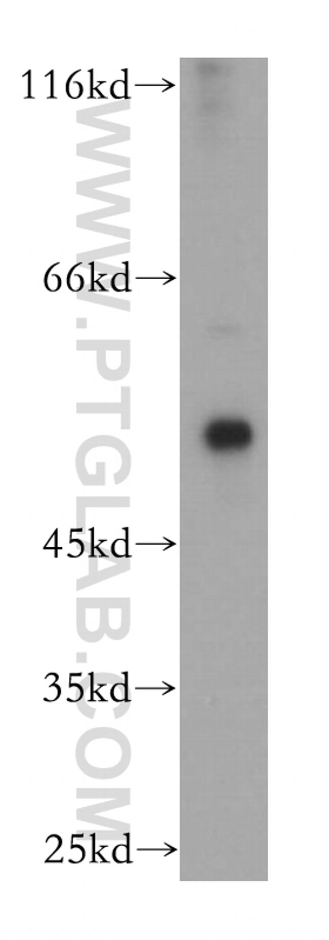 Calsequestrin 2 Antibody in Western Blot (WB)