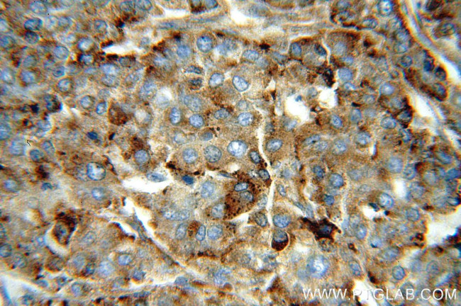 PSAP Antibody in Immunohistochemistry (Paraffin) (IHC (P))