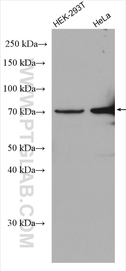 PSAP Antibody in Western Blot (WB)