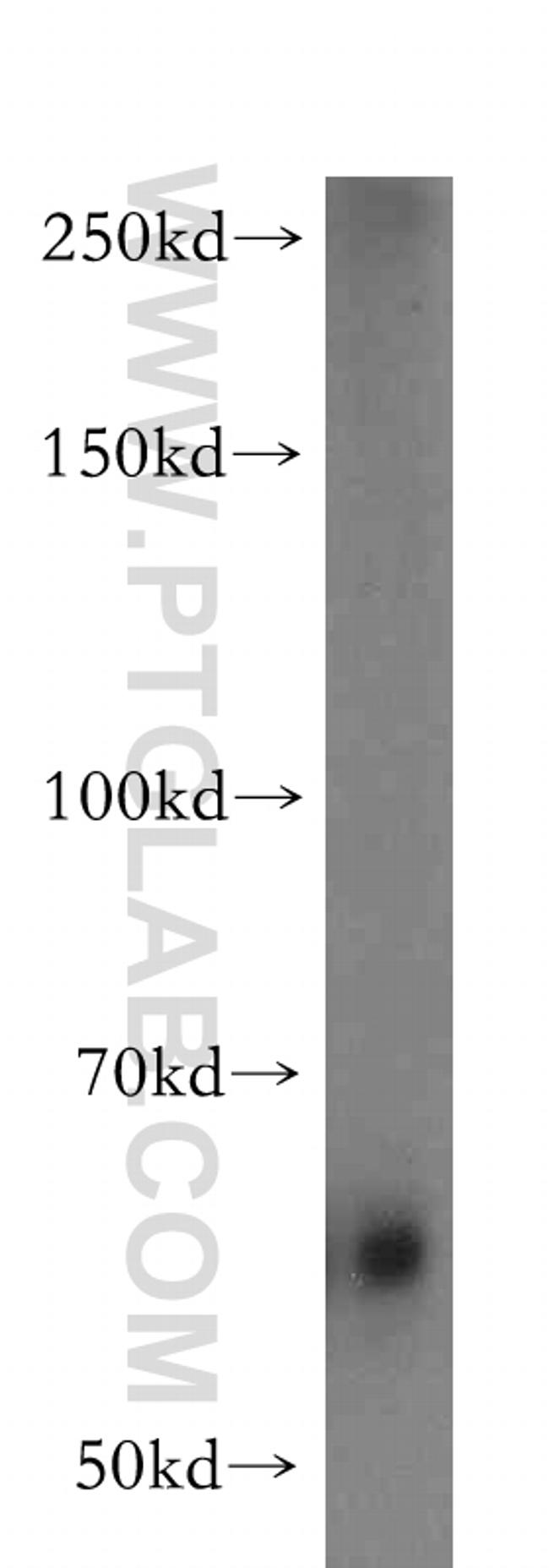 PSAP Antibody in Western Blot (WB)