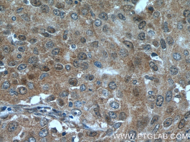 PRMT5 Antibody in Immunohistochemistry (Paraffin) (IHC (P))