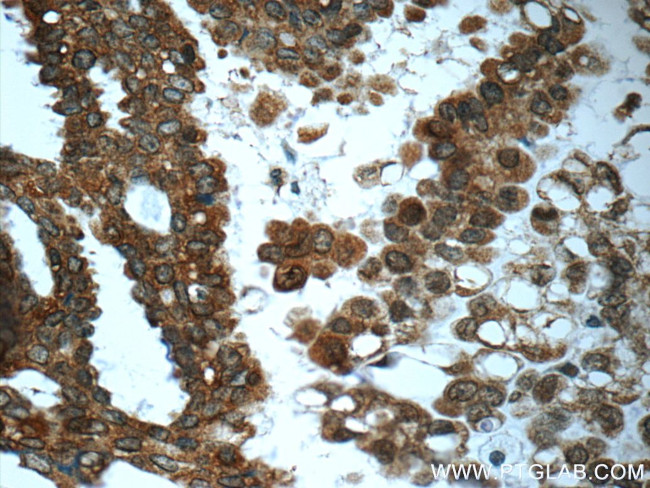 PRMT5 Antibody in Immunohistochemistry (Paraffin) (IHC (P))