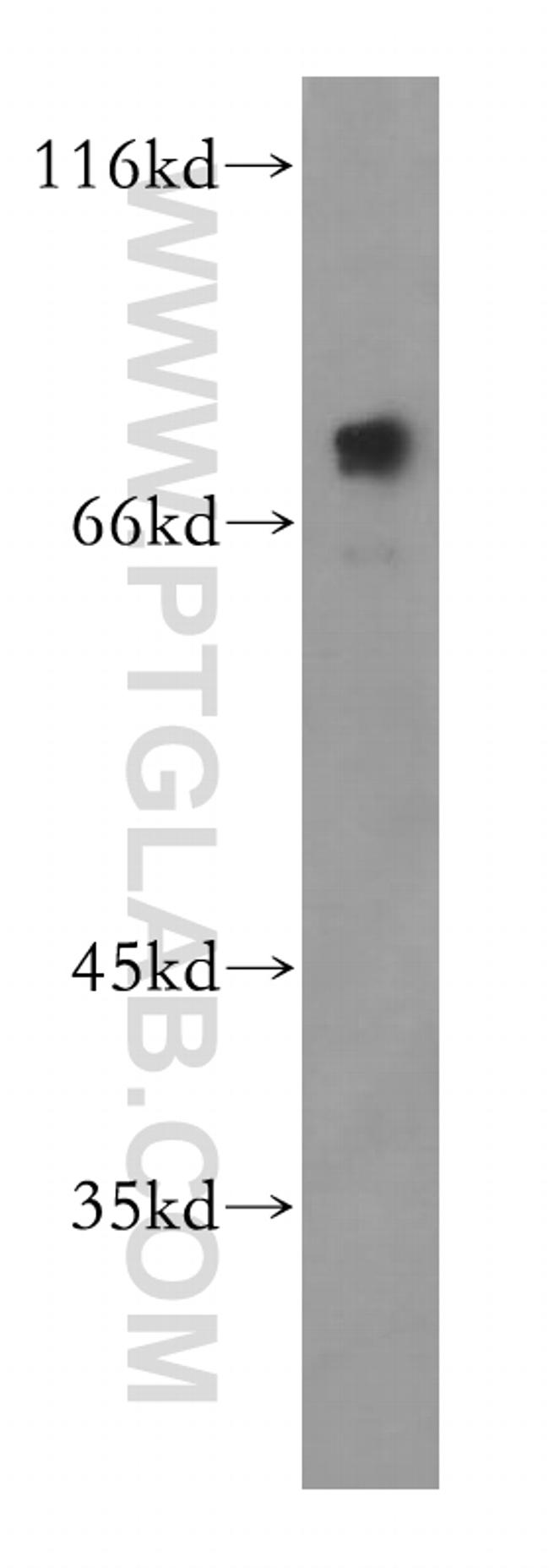 PRMT5 Antibody in Western Blot (WB)