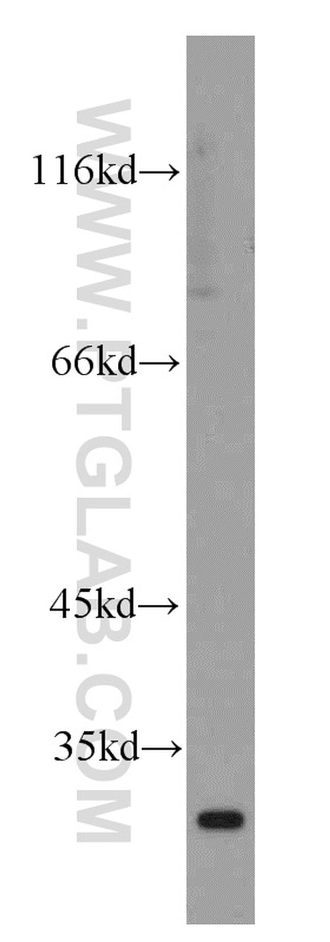 Cathepsin V Antibody in Western Blot (WB)