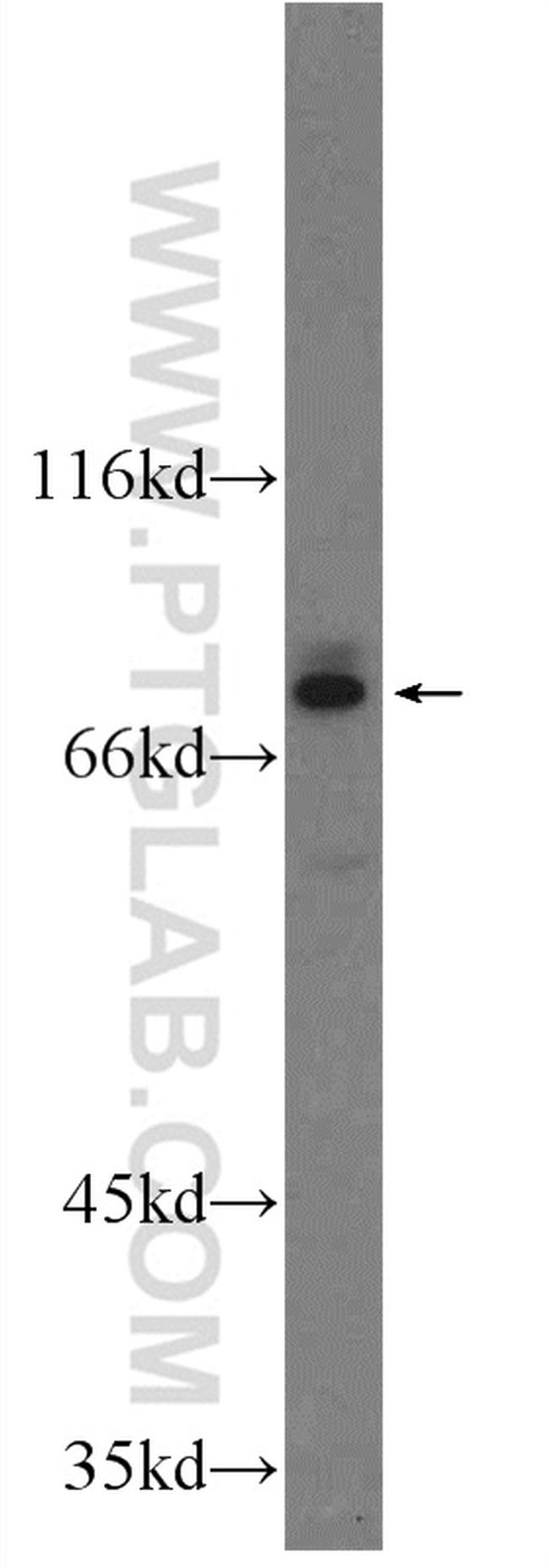 Cathepsin V Antibody in Western Blot (WB)