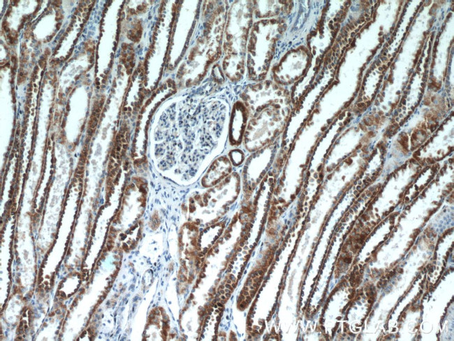 UQCRFS1 Antibody in Immunohistochemistry (Paraffin) (IHC (P))