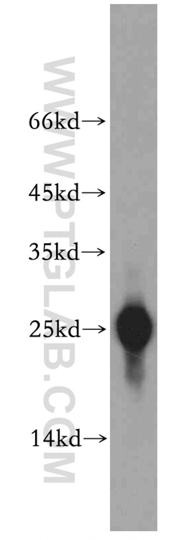 UQCRFS1 Antibody in Western Blot (WB)