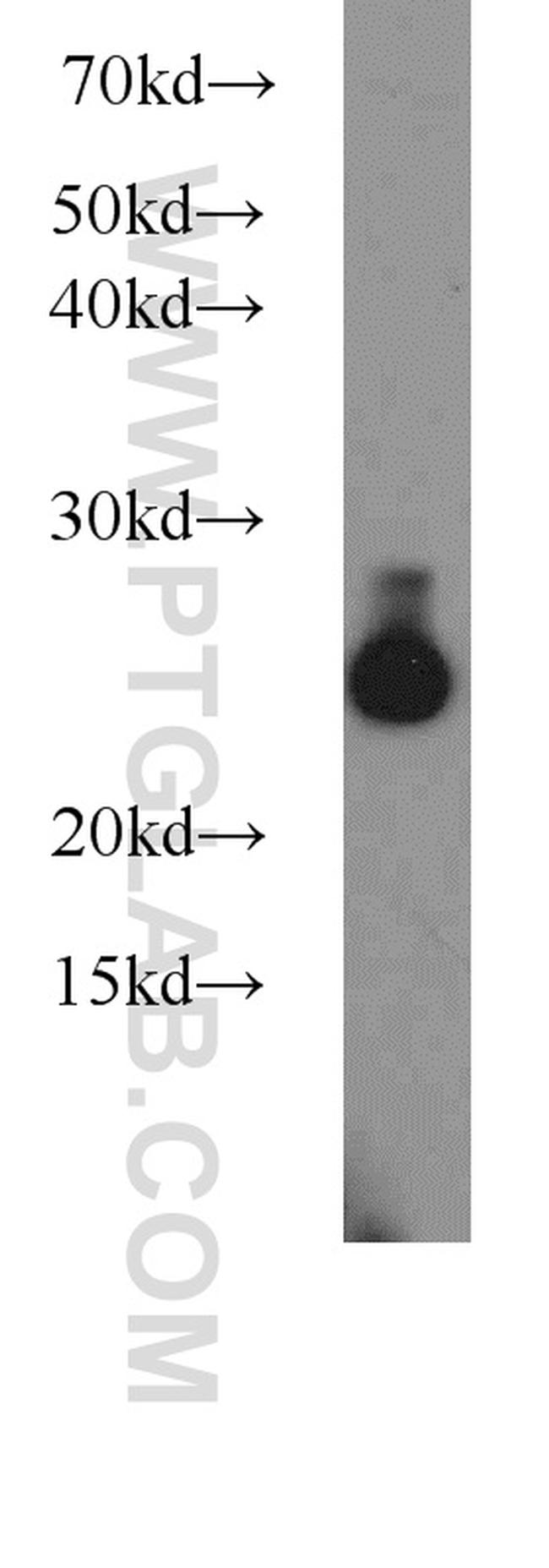 UQCRFS1 Antibody in Western Blot (WB)