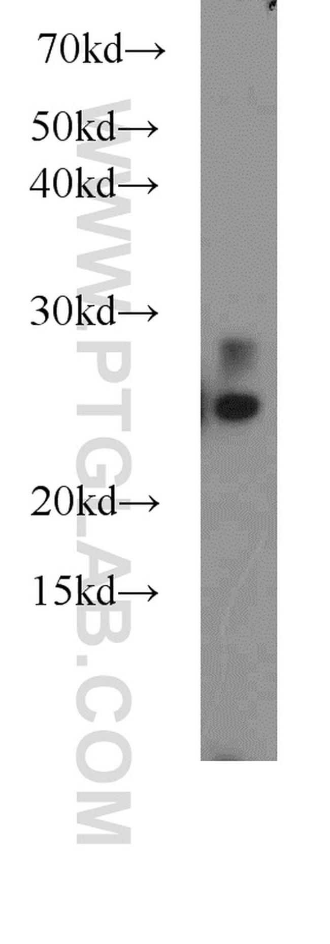 UQCRFS1 Antibody in Western Blot (WB)