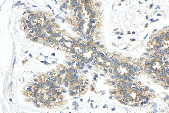 USP37 Antibody in Immunohistochemistry (Paraffin) (IHC (P))