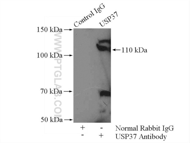 USP37 Antibody in Immunoprecipitation (IP)