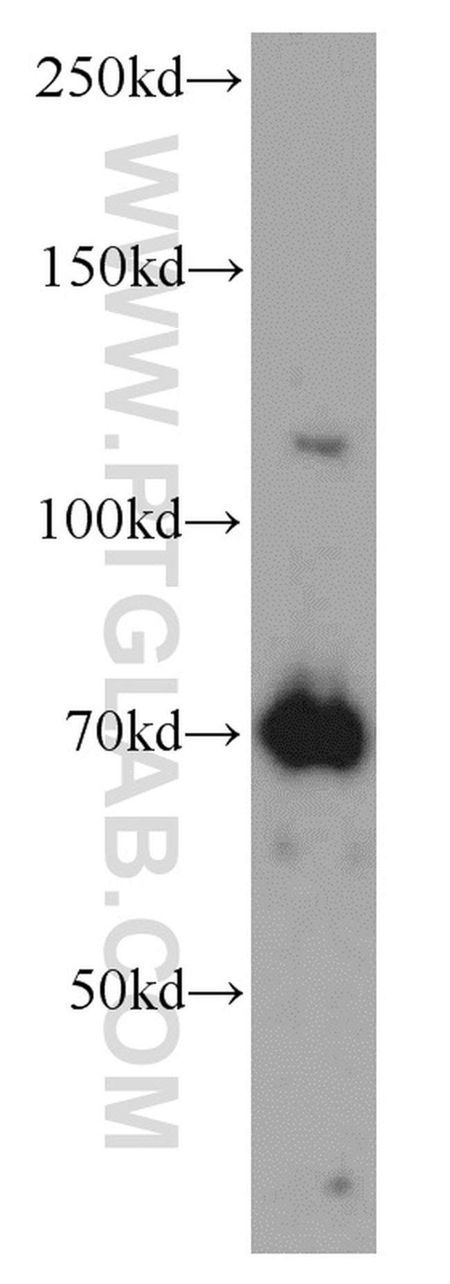 USP37 Antibody in Western Blot (WB)