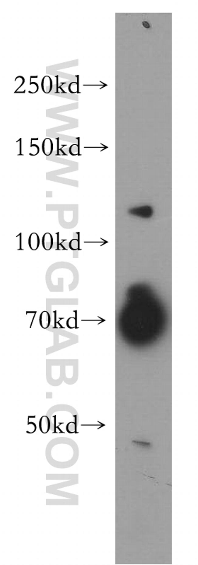 USP37 Antibody in Western Blot (WB)