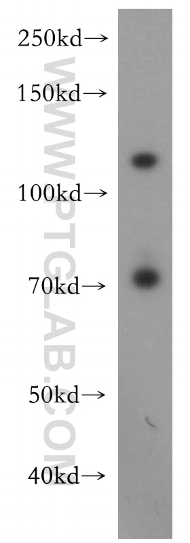 USP37 Antibody in Western Blot (WB)