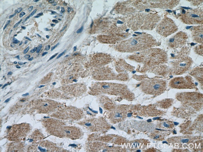 PPIF Antibody in Immunohistochemistry (Paraffin) (IHC (P))