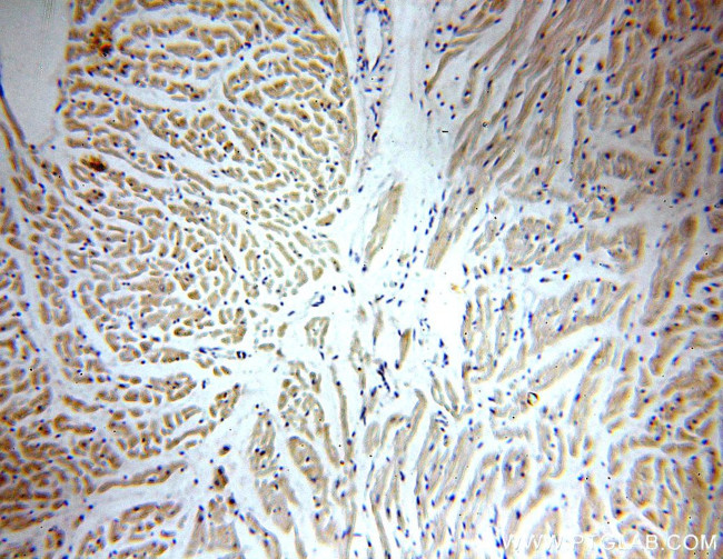 PPIF Antibody in Immunohistochemistry (Paraffin) (IHC (P))