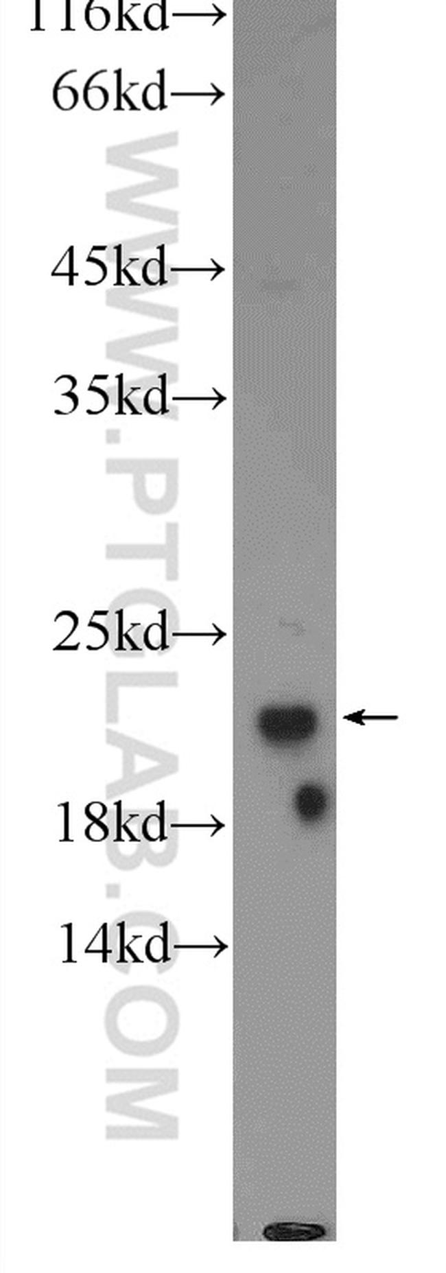 PPIF Antibody in Western Blot (WB)