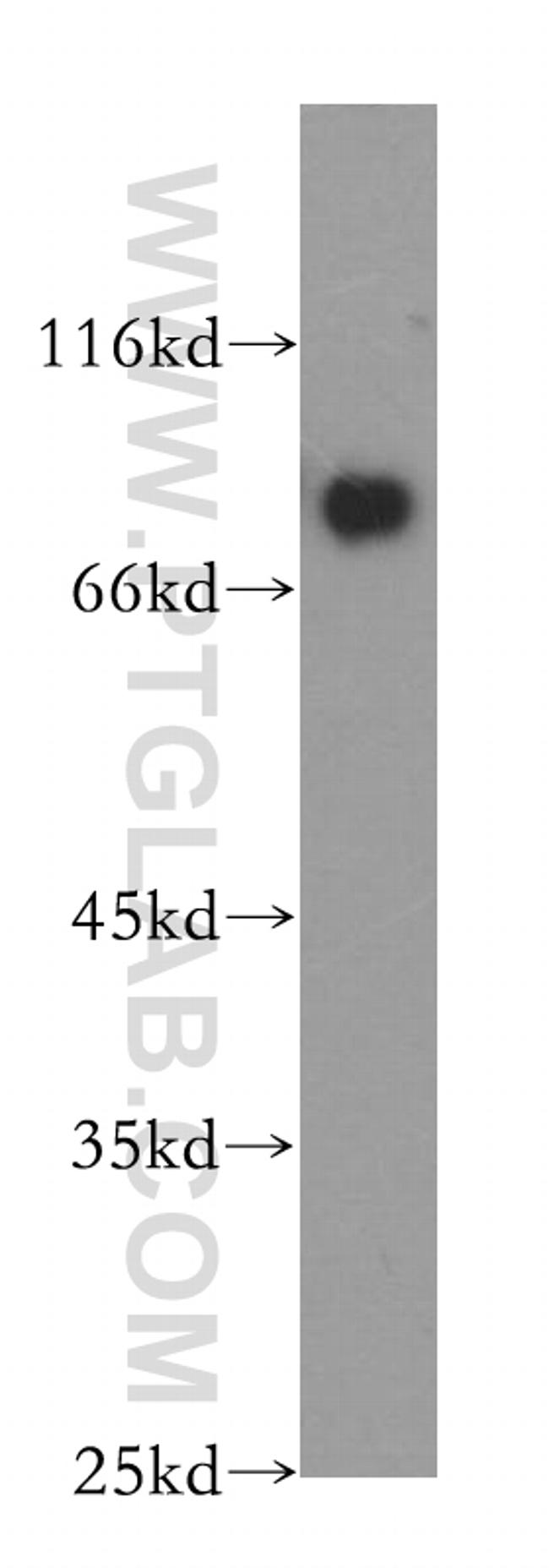 PIAS4 Antibody in Western Blot (WB)