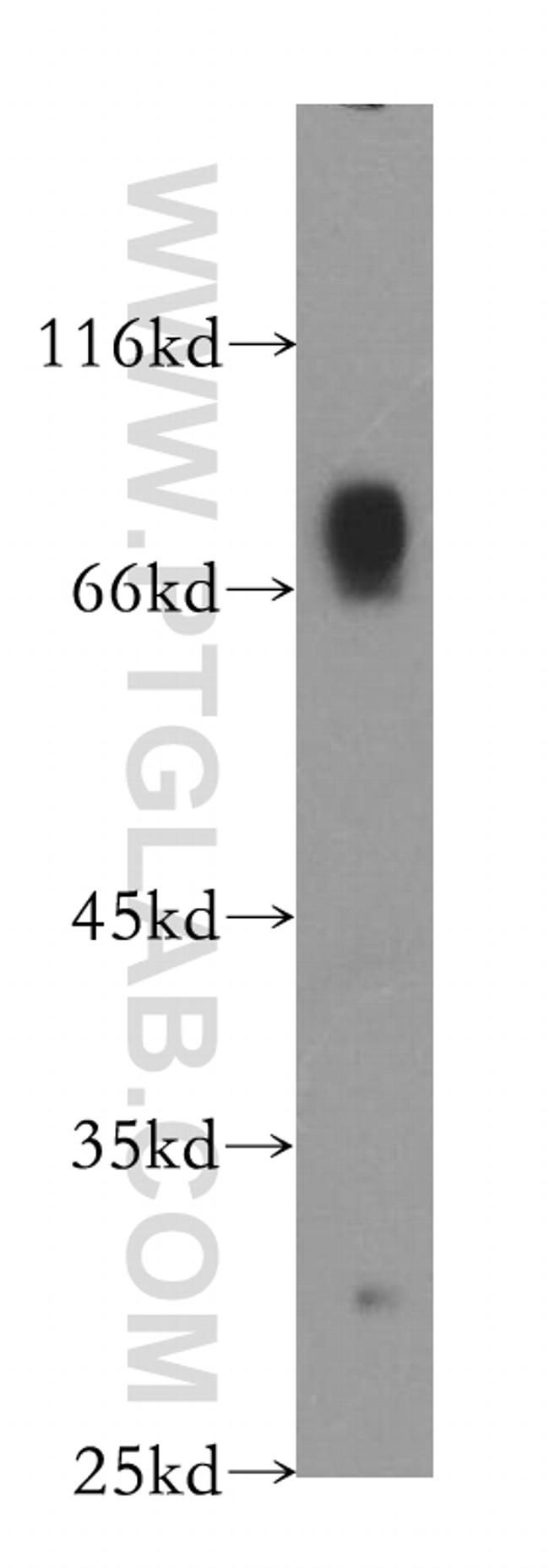 PIAS4 Antibody in Western Blot (WB)