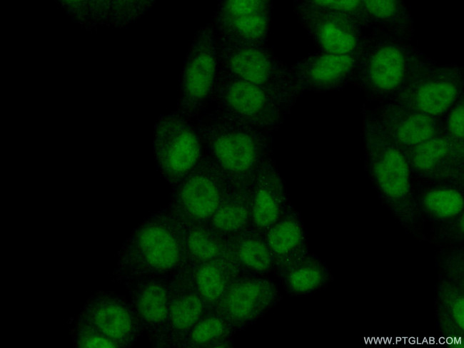 PIAS4 Antibody in Immunocytochemistry (ICC/IF)